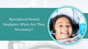 Specialized Dental Implants: When Are They Necessary? 